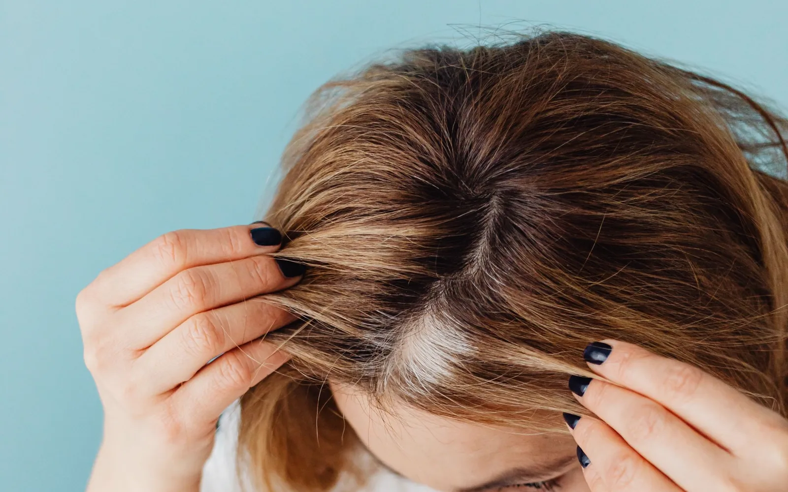 Hands parting hair at the crown to inspect the scalp underneath